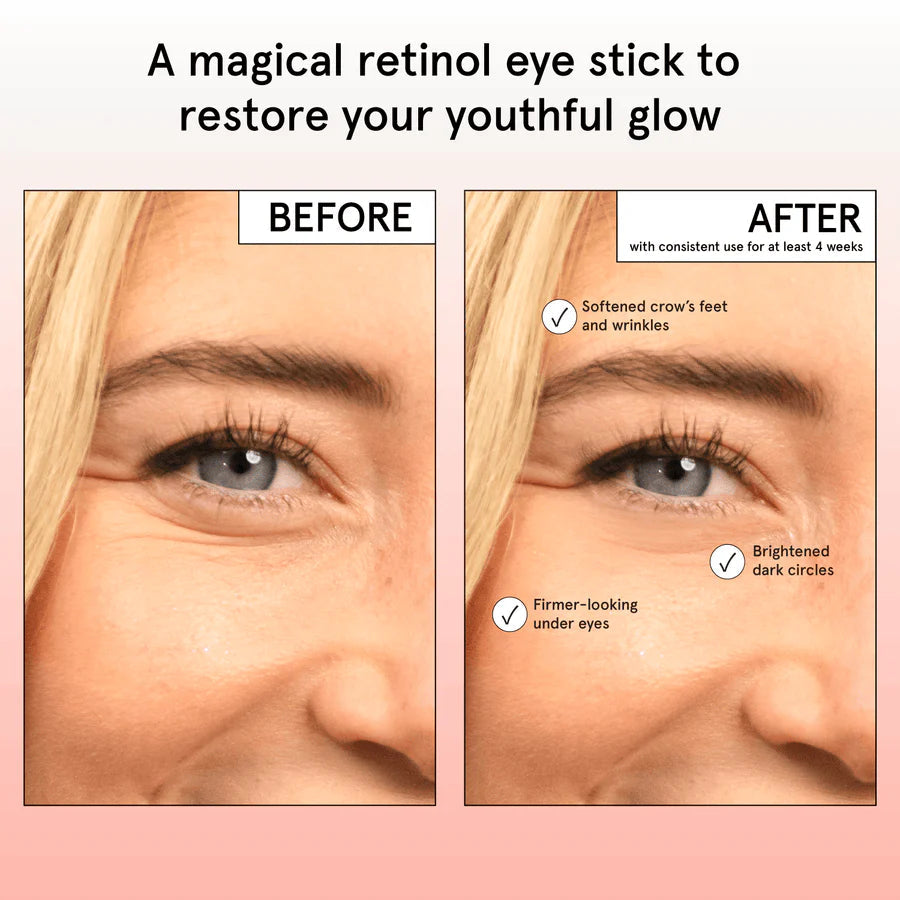 restoring eye balm