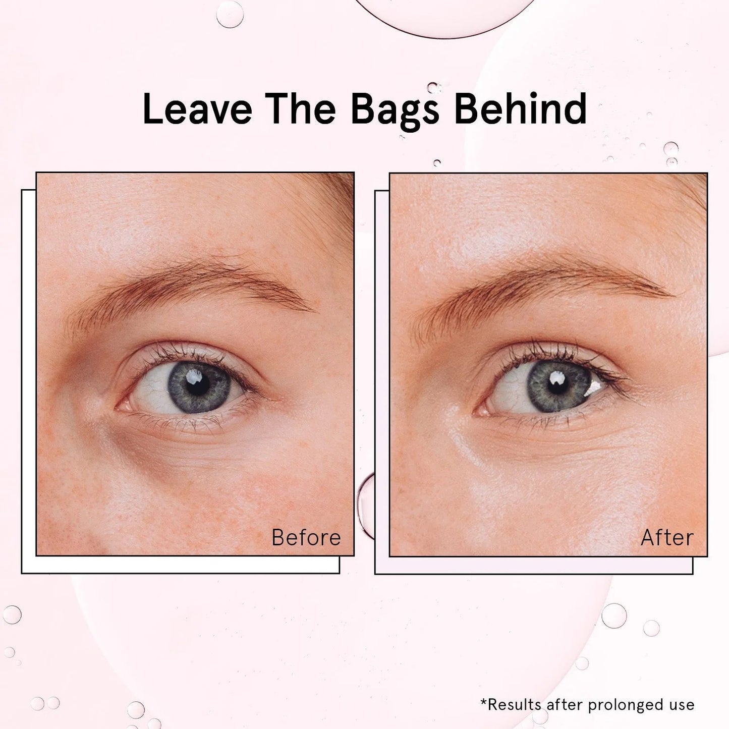 de-puffing eye serum roller